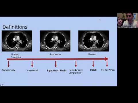 Massive Pulmonary Embolism