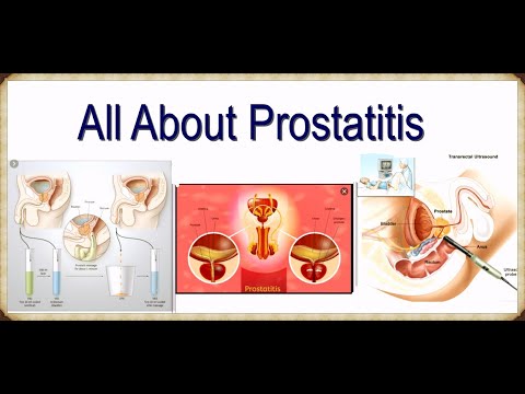 A prostatitis amely el tud menni