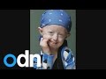Britains oldest teenager dies: Tributes to Progeria.