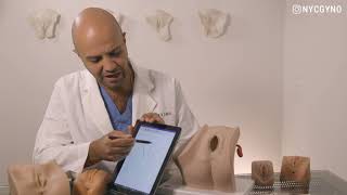 What is clitoral hood reduction