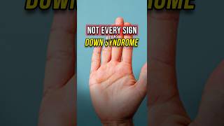Download lagu Not Every Sign Means Down Syndrome | A/Prof Stacey Tay mp3
