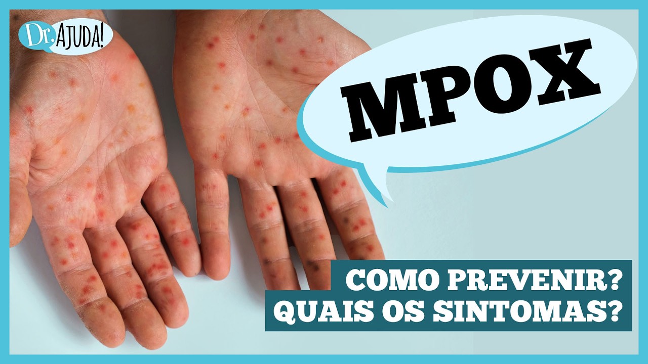 O que é Mpox ou Varíola dos Macacos? Quais os sintomas? Como é a transmissão? #mpox #mpoxvirus