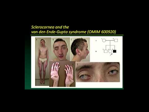 The Search for Mendelian Disease Genes: Opportunities Afforded, Lessons Learned - David Valle (2014)