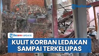 Ledakan Misterius di Tangsel akibatkan Warga Luka hingga Kulit Terkelupas, Suara Ledakan hingga 3 Km