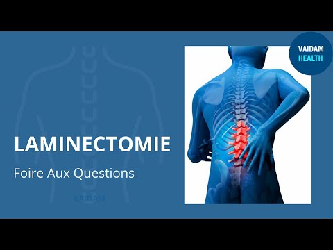 LAMINECTOMIE