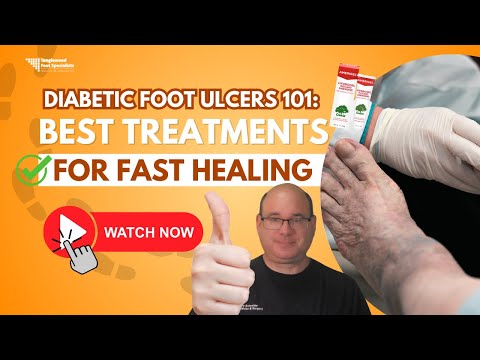Diabetic Foot Ulcers 101: Best Treatments for Fast Healing