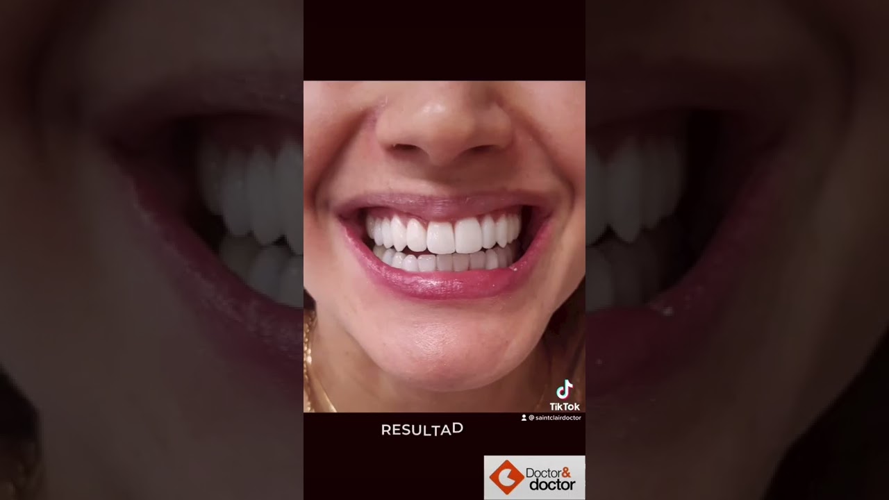 Saint Clair Barbosa Netto-35