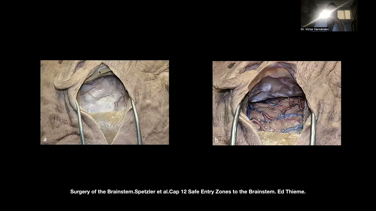 Victor Hernandez Alvarez-13