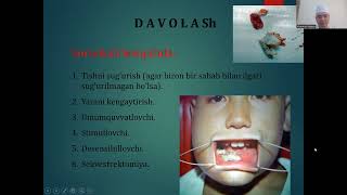 Bolalarda jag’ suyaklarining odontogen yallig‘lanish kasalliklari