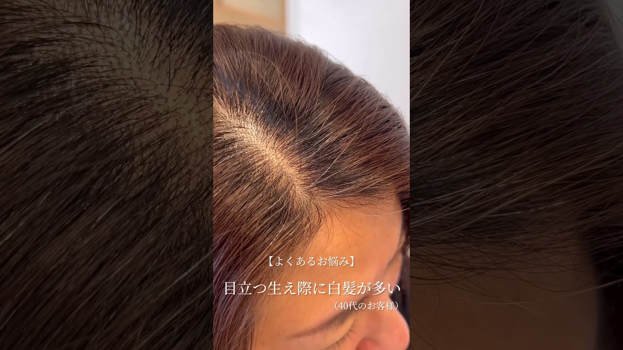 生え際の白髪…染め続けて大丈夫？#shorts #白髪染め #頭皮ケア #生え際 #40代 #50代