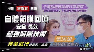 [問題] 有聽過筋膜填充嗎？