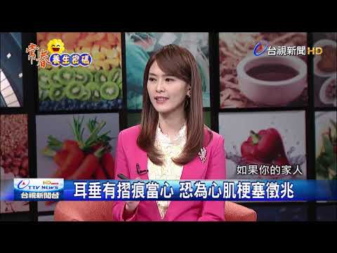 血管狹窄大於50% 稱作穩定型心絞痛