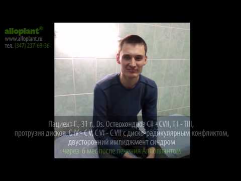 Атлантоосевой сустав что это Показать строение шейного отдела позвоночника