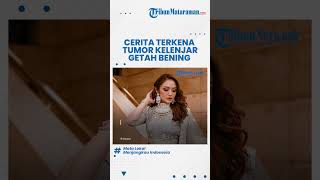 Awalnya Dikira Jerawat, Cerita Siti Badriah Terkena Penyakit Tumor Kelenjar Getah Bening