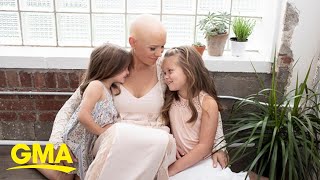 Mom with alopecia opens up about hair loss journey and her message to her daughters l GMA