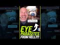 There’s a Parasite in his Eye!!! 😱 #shorts