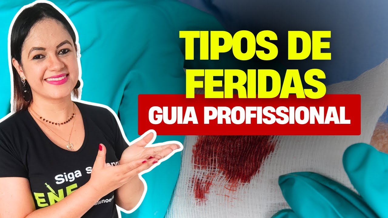 CLASSIFICAÇÃO DE FERIDAS (Aula completa) - Profª Juliana Mello