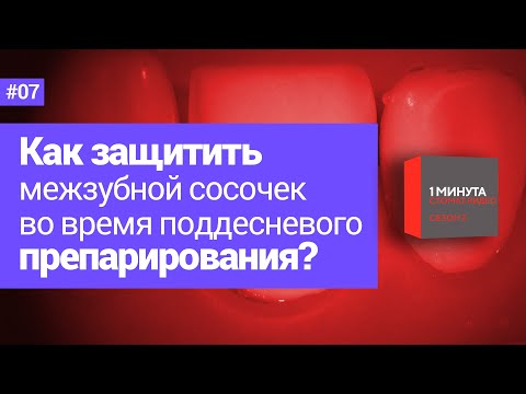 Как защитить межзубной сосочек во время поддесневого препарирования?