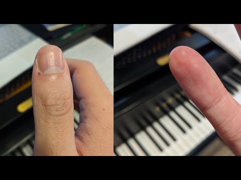 My Piano Injuries | Dr. Allen Yueh