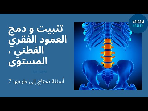الأسئلة المتداولة حول التثبيت القطني والدمج