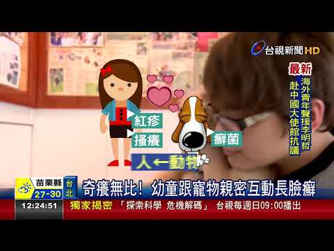 愛跟狗狗玩親親!5歲女童粉嫩臉長癬