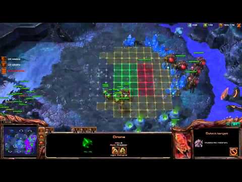 Destiny vs Deezer - 1 / 2