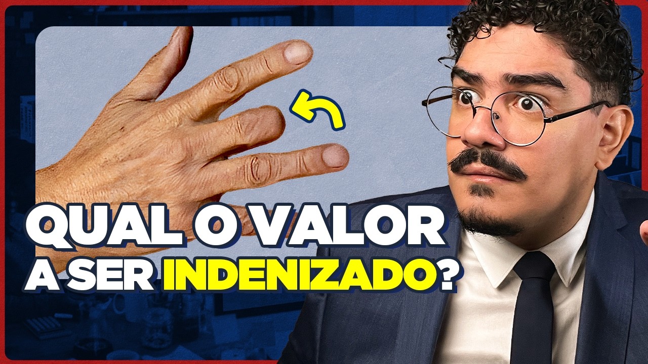 VALOR de Indenização por PERDA DE DEDO Médio no TRABALHO: Um Caso REAL!