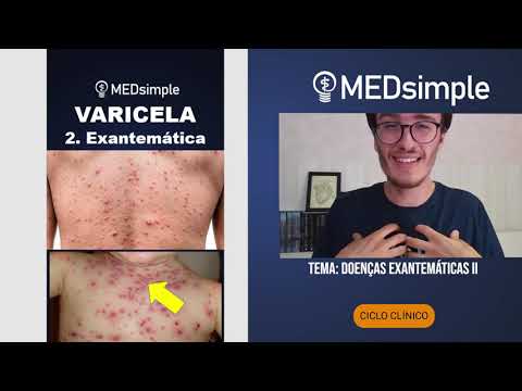 Tema de estudo: DOENÇAS EXANTEMÁTICAS II (Ciclo Clínico)