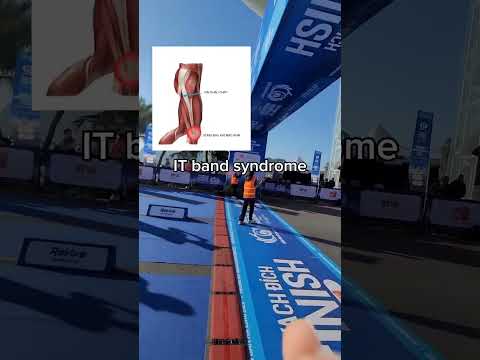 Síndrome da banda IT #itband #hoichungdaichauchay