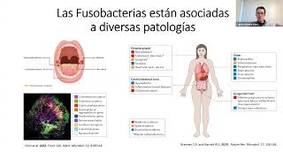 [Camilo Gómez-Garzón]  Cáncer Gástrico: ¿una historia de dos bacterias?