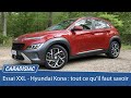 Essai XXL - Hyundai Kona (2021) : tout ce qu'il faut savoir