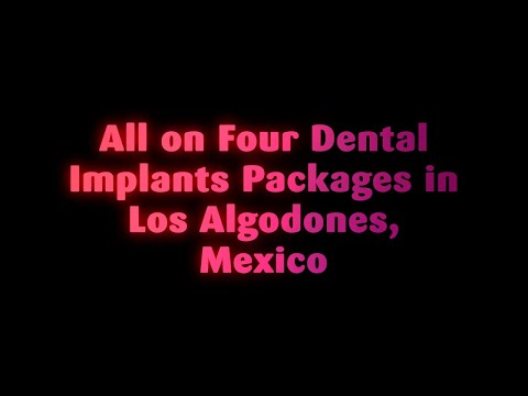 The Best All on Four Dental Implants Packages in Los Algodones, Mexico