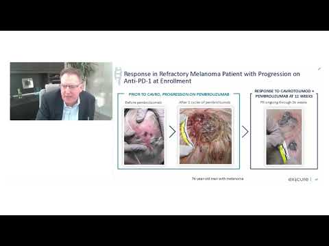 Exicure Cavrotolimod KOL day highlights