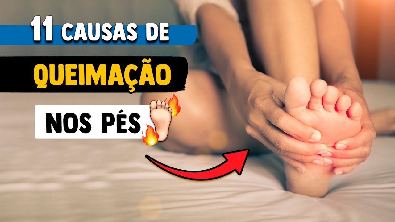 11 CAUSAS de QUEIMAÇÃO, DOR e FORMIGAMENTO nos pés │ Médico Explica