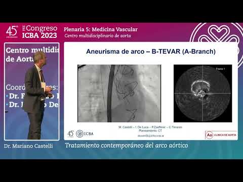 Tratamiento contemporáneo del arco aórtico - Dr. Mariano Castelli