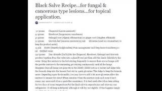 Monika Milka Duty of Care and Black Salve pt2