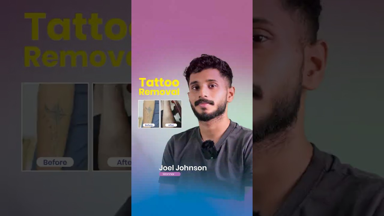 Tattoo Removal Before & After – Real Results | Joel | DermaVue #tattooremoval