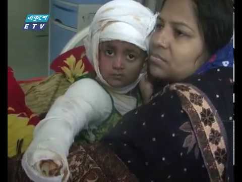 আগুন পোহাতে গিয়ে এক সপ্তাহে দগ্ধ হয়ে মারা গেছেন ৫ জন