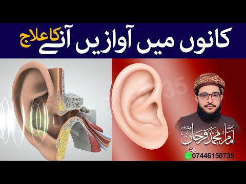 Kano Mein Awazien Aanay Ka Ailaj | کانوں میں آوازیں آنے کا علاج | Noise In Ear | Farhan Siddique