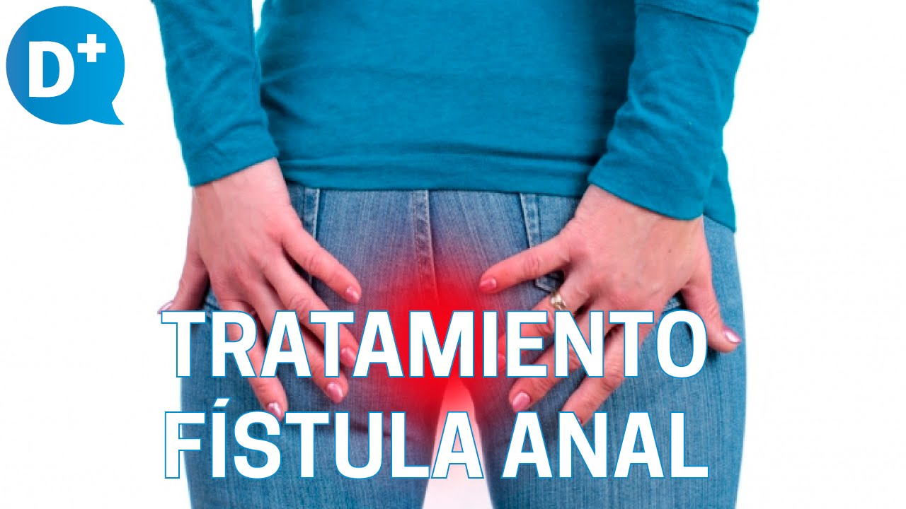 Watch Diagnóstico y tratamiento de la fístula anal Now Diagnóstico y tratamiento de la fístula anal