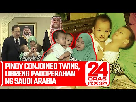 Pinoy conjoined twins, libreng paooperahan ng Saudi Arabia 24 Oras Weekend Shorts