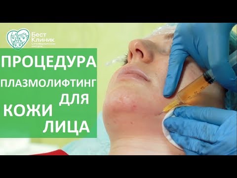 Spostamento delle vertebre della colonna cervicale Della parte di giunzione