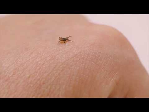 CT Ticks- Lyme Disease