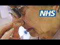 How To Treat A Nosebleed NHS