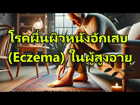 ไม่ว่าจะเป็นโรคสะเก็ดเงินที่ป่วยอยู่บนหัว ถ้าสามีโรคสะเก็ดเงิน
