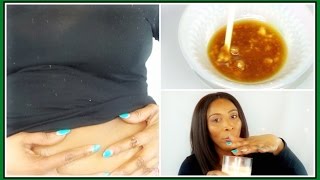 HOW TO SHRINK FIBROIDS NATURALLY | POWERFUL WARMING OIL MIXTURE| 100% EFFECTIVE |Khichi Beauty