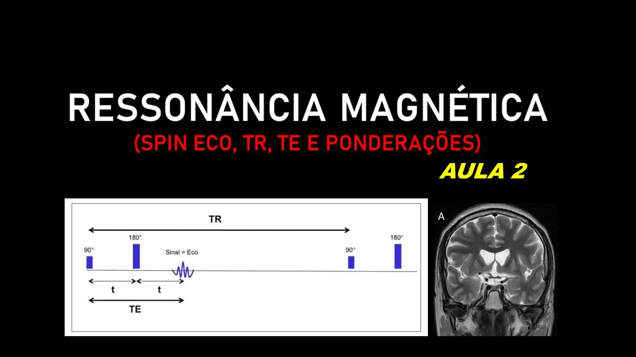 RESSONÂNCIA MAGNÉTICA - AULA 2 (Spin Eco, TR, TE e ponderações) *revisado*
