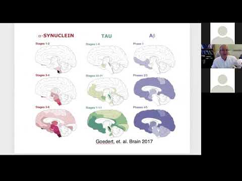 Cognitive and Psychiatric Aspects of Parkinson's Disease
