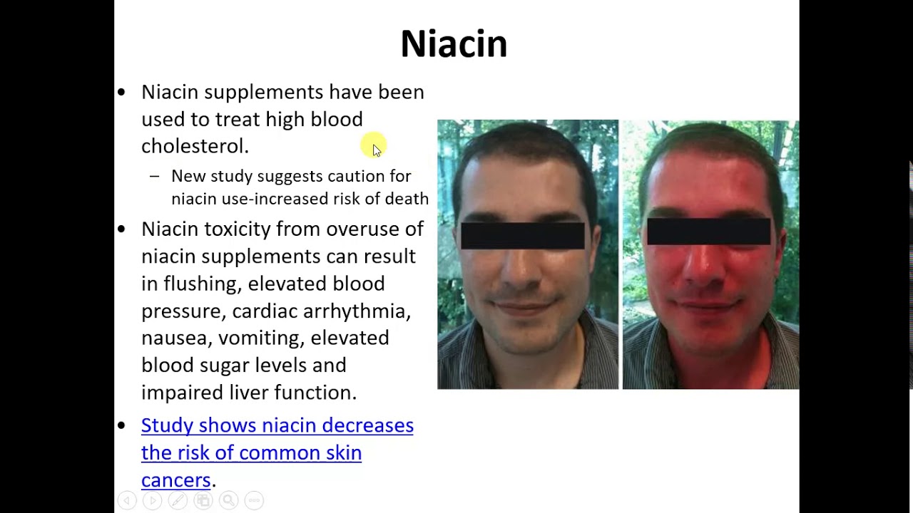 Chapters 8 & 9 Lecture.webm