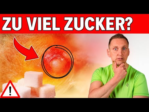 10 Warnzeichen, dass du zu viel Zucker isst!